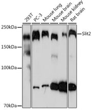 Slit2 Rabbit mAb