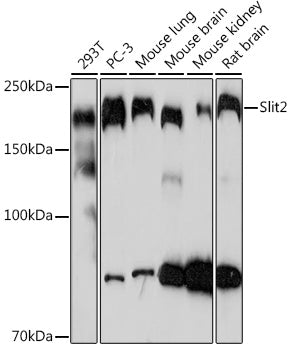 Slit2 Rabbit mAb