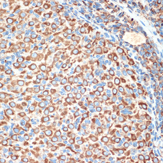 Slit2 Rabbit mAb