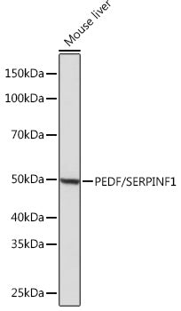 PEDF/SERPINF1 Rabbit mAb