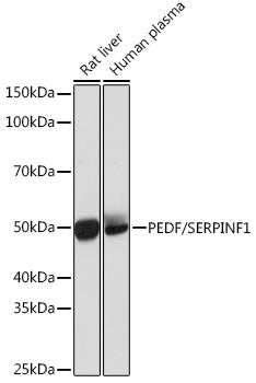 PEDF/SERPINF1 Rabbit mAb