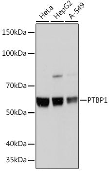 PTBP1 Rabbit mAb
