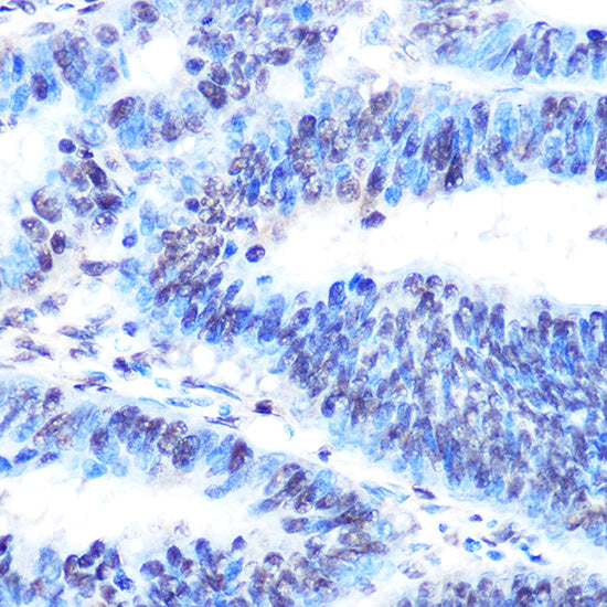 PTBP1 Rabbit mAb