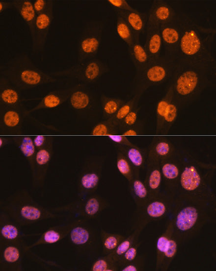 PTBP1 Rabbit mAb