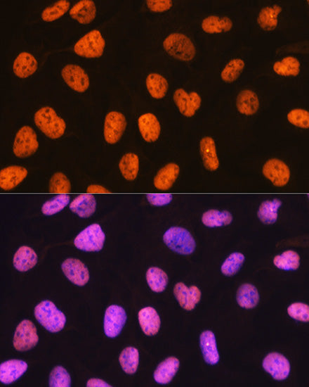 PTBP1 Rabbit mAb