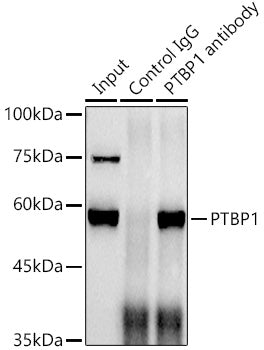 PTBP1 Rabbit mAb