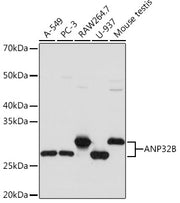 ANP32B Rabbit mAb