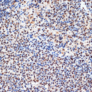 ANP32B Rabbit mAb