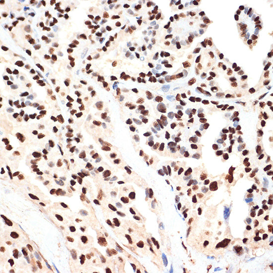 ANP32B Rabbit mAb