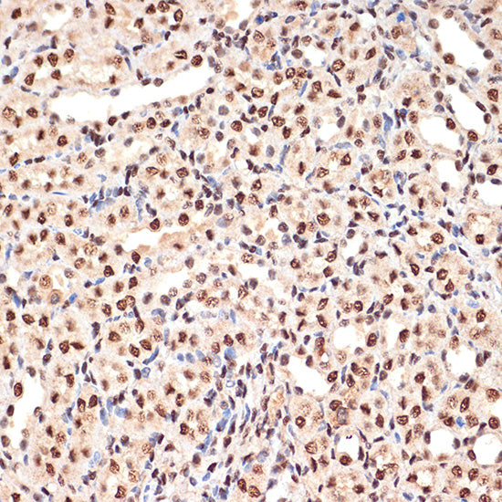 ANP32B Rabbit mAb