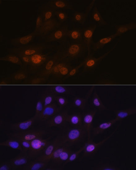 ANP32B Rabbit mAb