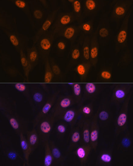 ANP32B Rabbit mAb