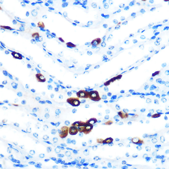 PIWIL1 Rabbit mAb