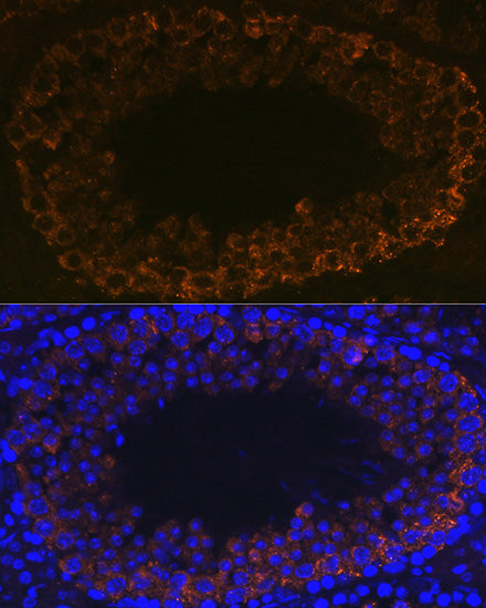 PIWIL1 Rabbit mAb