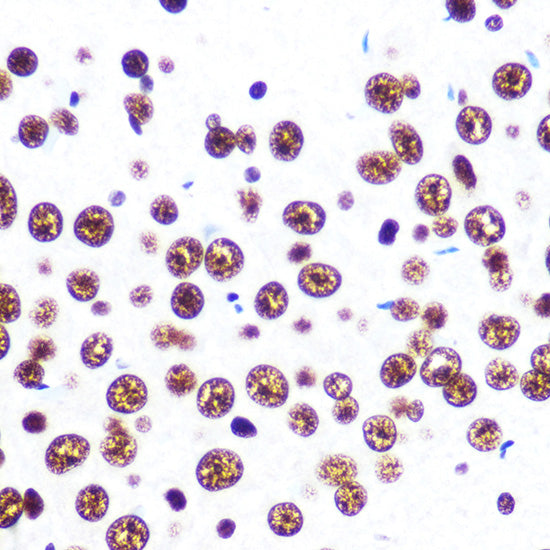 SFPQ Rabbit mAb