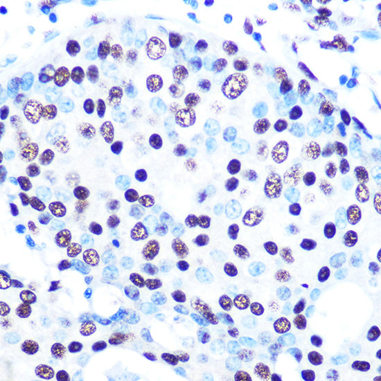 SFPQ Rabbit mAb