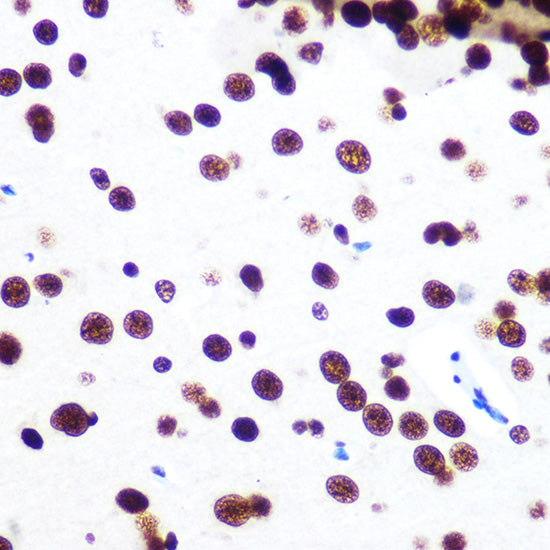 SFPQ Rabbit mAb