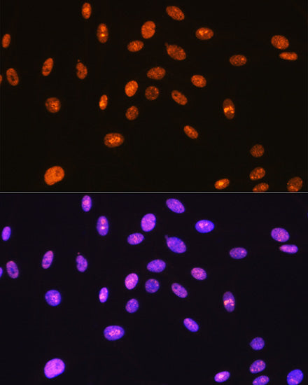 SFPQ Rabbit mAb