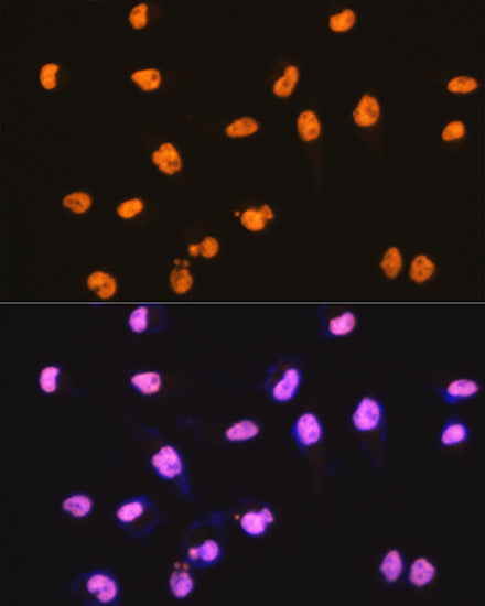 SFPQ Rabbit mAb