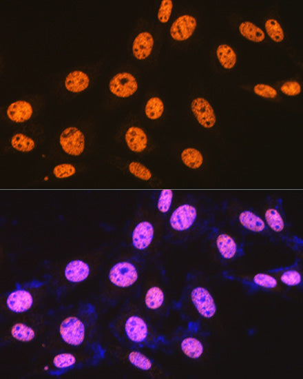 SFPQ Rabbit mAb