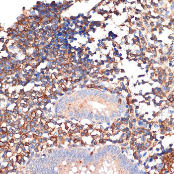 EHD1 Rabbit mAb