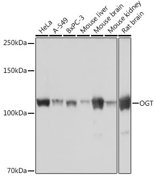 OGT Rabbit mAb
