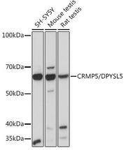 CRMP5/DPYSL5 Rabbit mAb