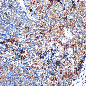 CRMP5/DPYSL5 Rabbit mAb