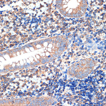 CRMP5/DPYSL5 Rabbit mAb