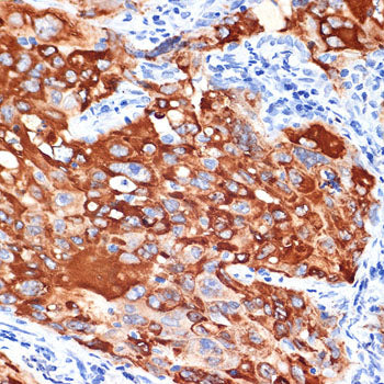 IL13RA1 Rabbit mAb