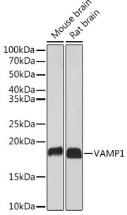 VAMP1 Rabbit mAb