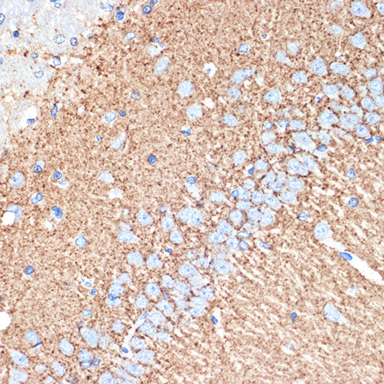 VAMP1 Rabbit mAb