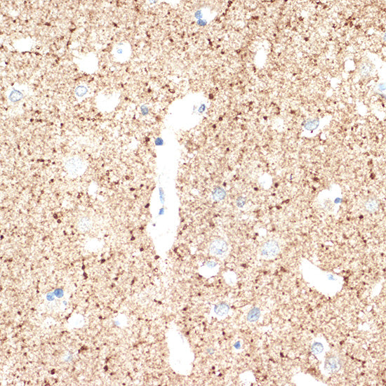 VAMP1 Rabbit mAb