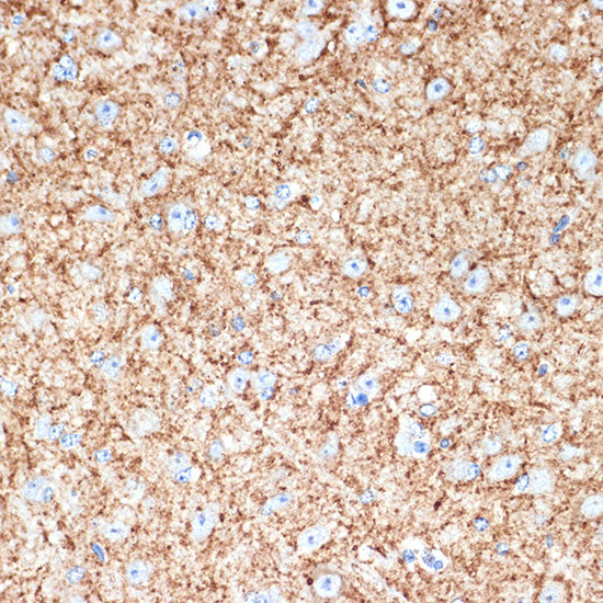 VAMP1 Rabbit mAb