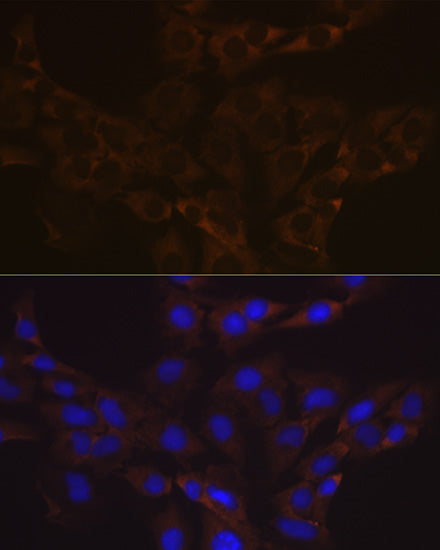 VAMP1 Rabbit mAb