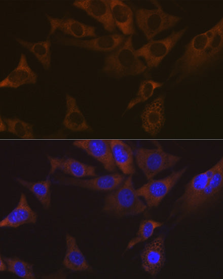 VAMP1 Rabbit mAb