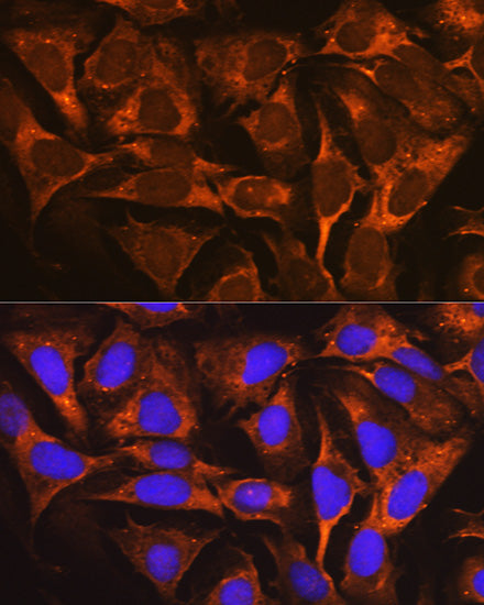 YB-1/YBX1 Rabbit mAb