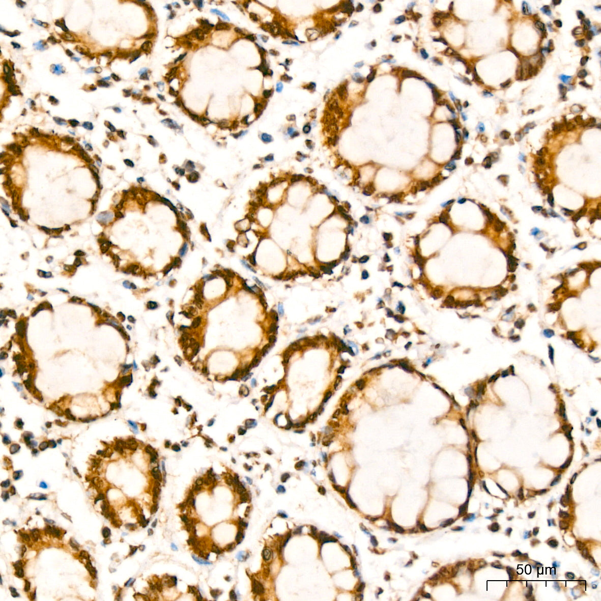 YB-1/YBX1 Rabbit mAb