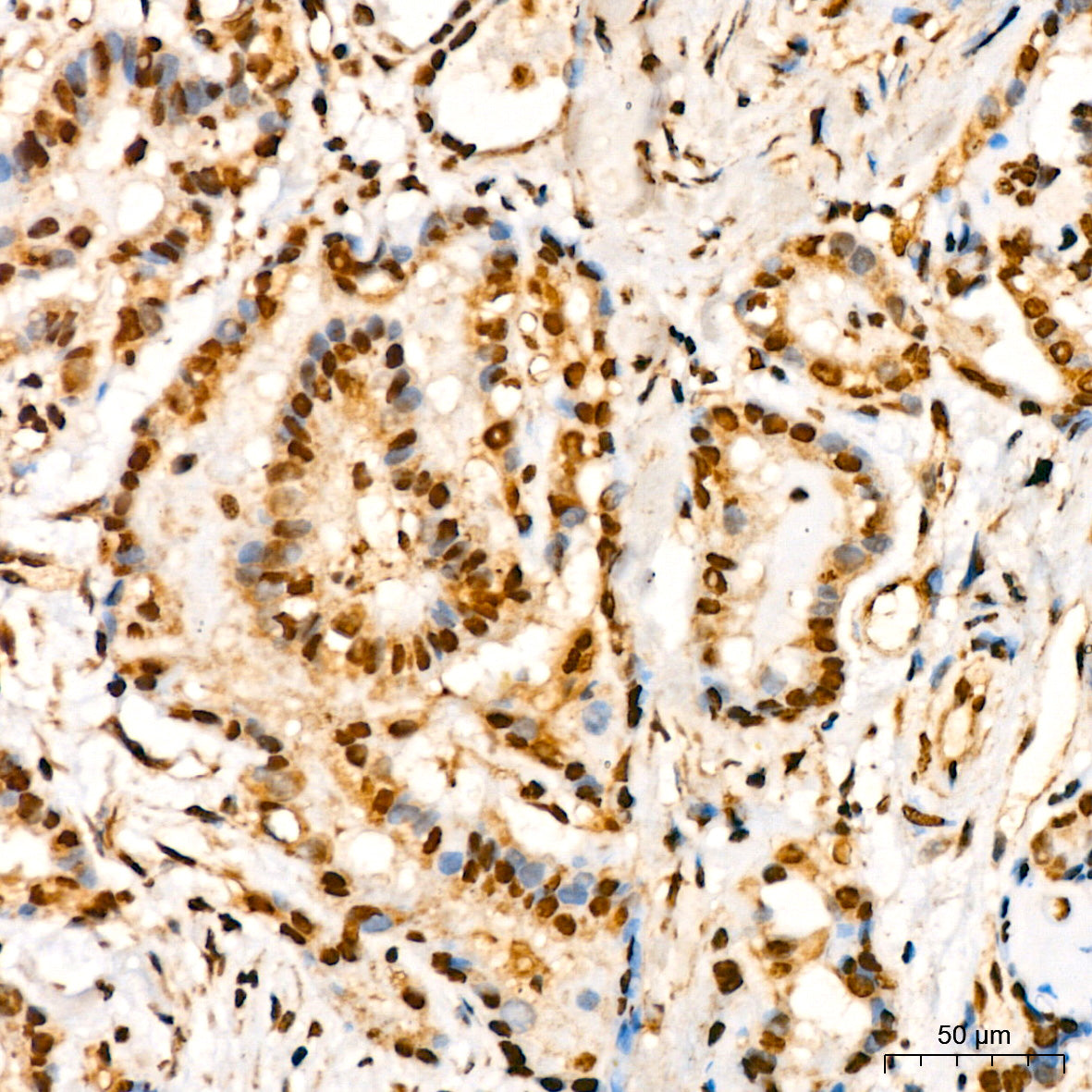 YB-1/YBX1 Rabbit mAb