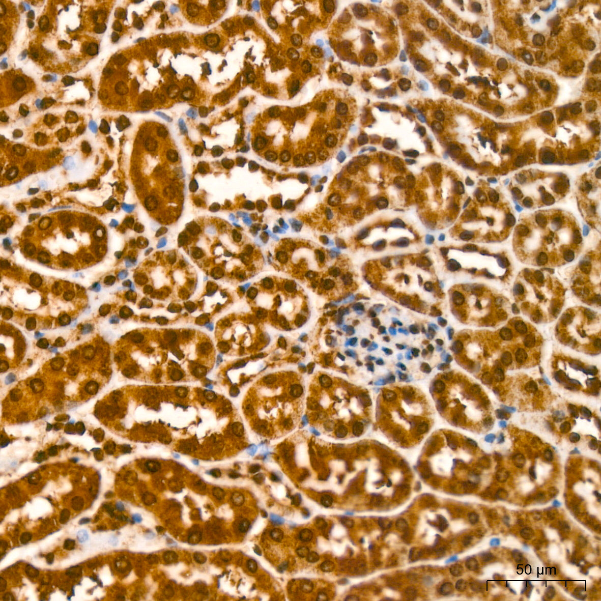 YB-1/YBX1 Rabbit mAb