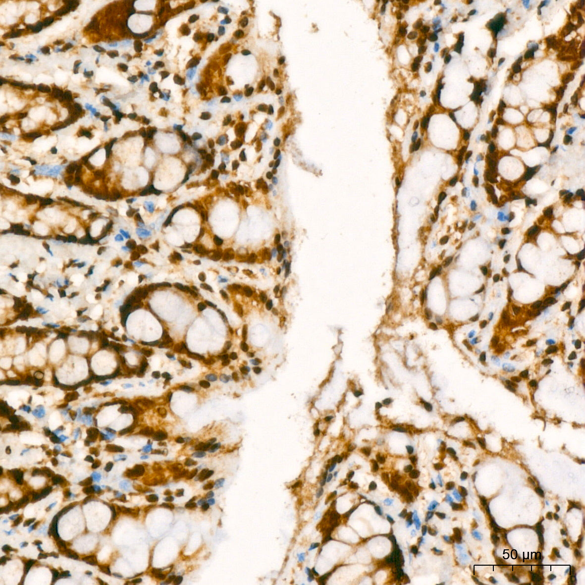 YB-1/YBX1 Rabbit mAb