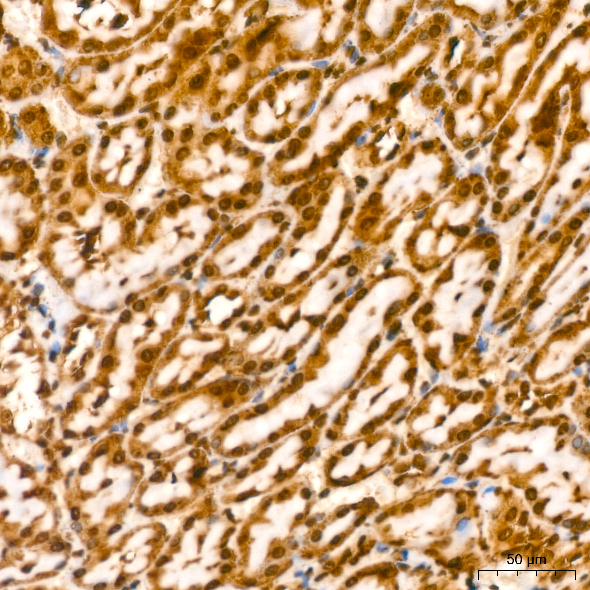 YB-1/YBX1 Rabbit mAb