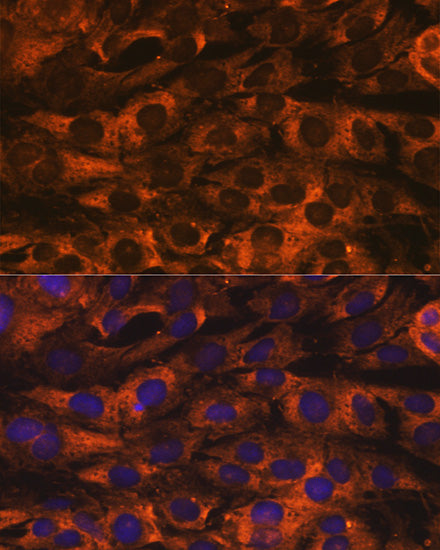 YB-1/YBX1 Rabbit mAb