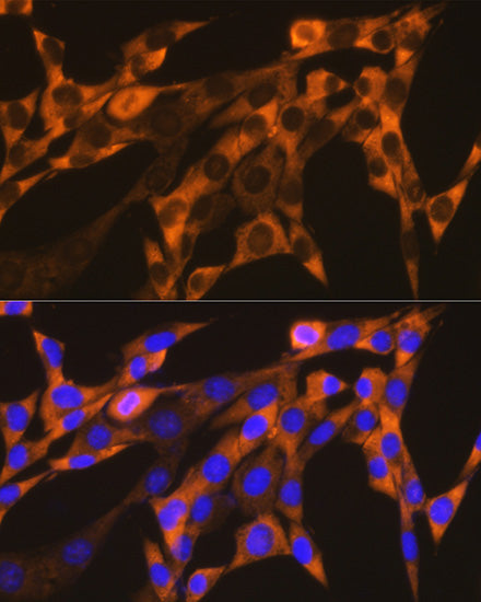 YB-1/YBX1 Rabbit mAb