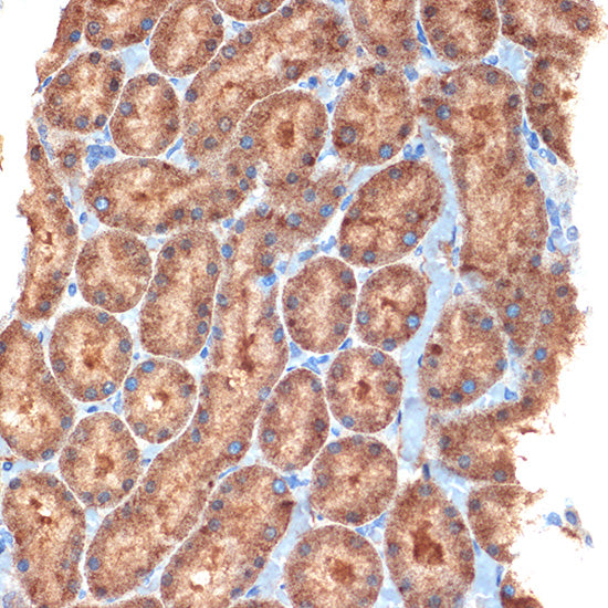 NEK6 Rabbit mAb