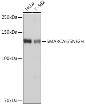 SMARCA5/SNF2H Rabbit mAb