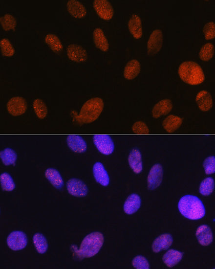 SMARCA5/SNF2H Rabbit mAb