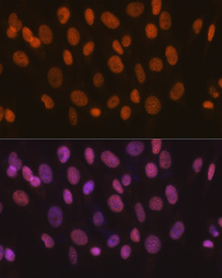 SMARCA5/SNF2H Rabbit mAb