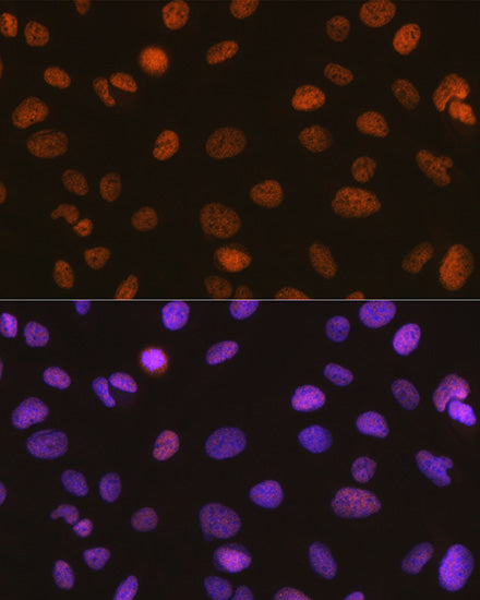 SMARCA5/SNF2H Rabbit mAb