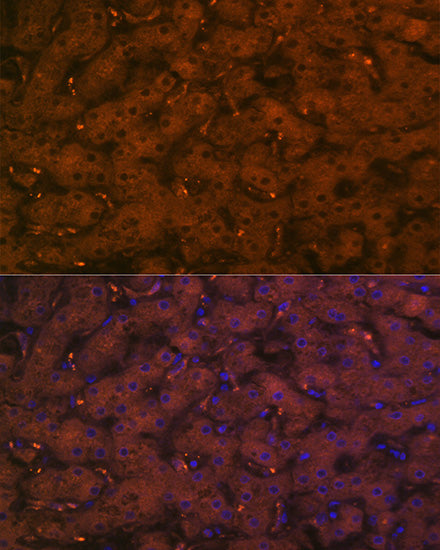 Complement C4A Rabbit mAb